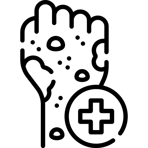 Lichen Planus